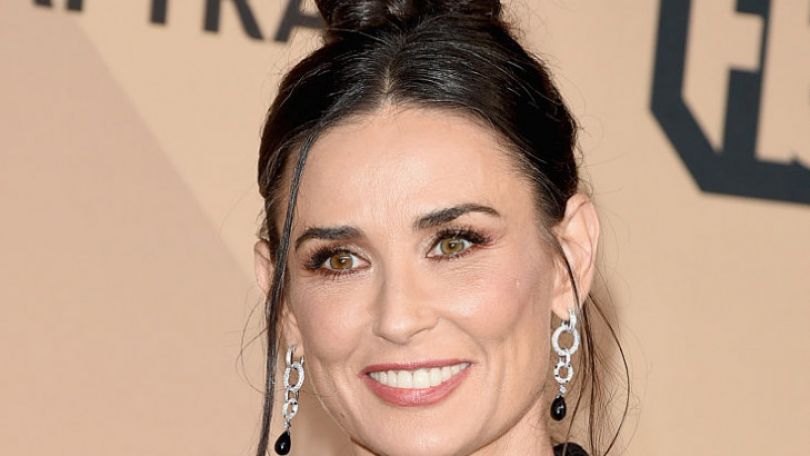 Термаж лица: все, что нужно знать о безоперационной подтяжке лица