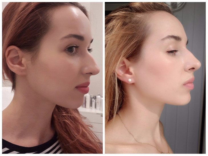 Онлайн изменить нос на фото онлайн
